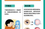 高原反应眼睛充血怎么办_高原眼睛充血多久能好