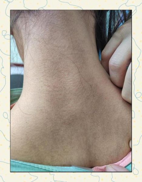 高原黑人皮肤变黑的原因_高原黑人如何防晒