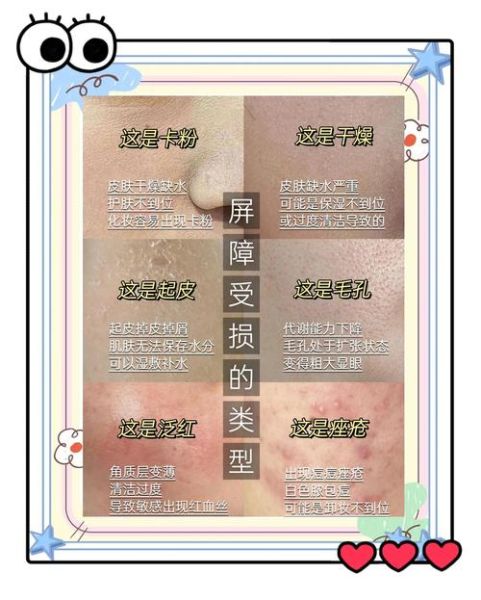 高原皮肤干燥怎么办_高原脸干起皮怎么快速缓解