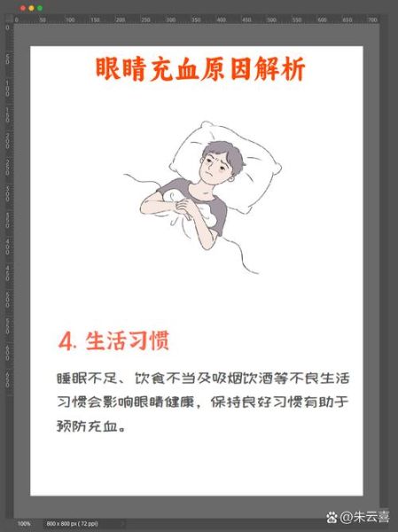 高原眼睛充血怎么办_高原反应眼睛红怎么缓解