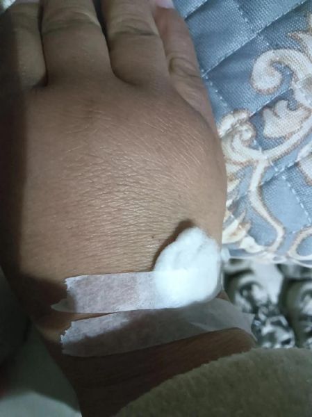 高原反应手发青怎么办_高原手青多久能恢复