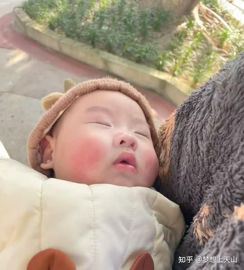 日本高原红小女孩_高原红成因