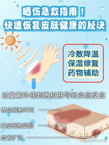 户外皮肤晒伤怎么办_户外皮肤如何防晒