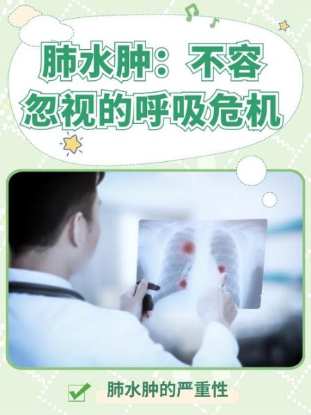 高原肺水肿初期症状_如何判断是否得了