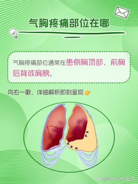 气胸高原反应_高原旅行如何避免气胸