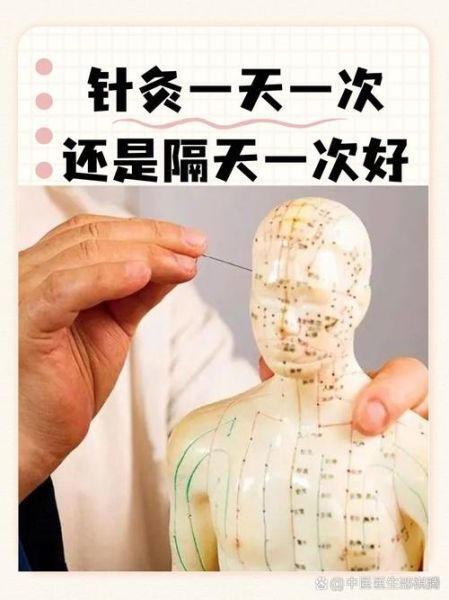 北京中医针灸哪里好_北京针灸一次多少钱