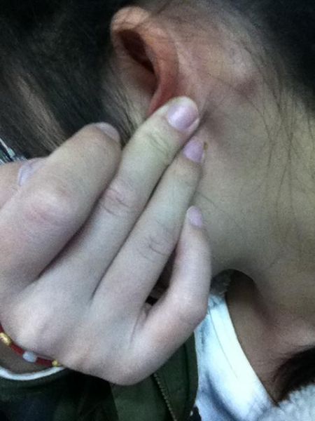 高原耳背是怎么回事_高原耳背多久能恢复